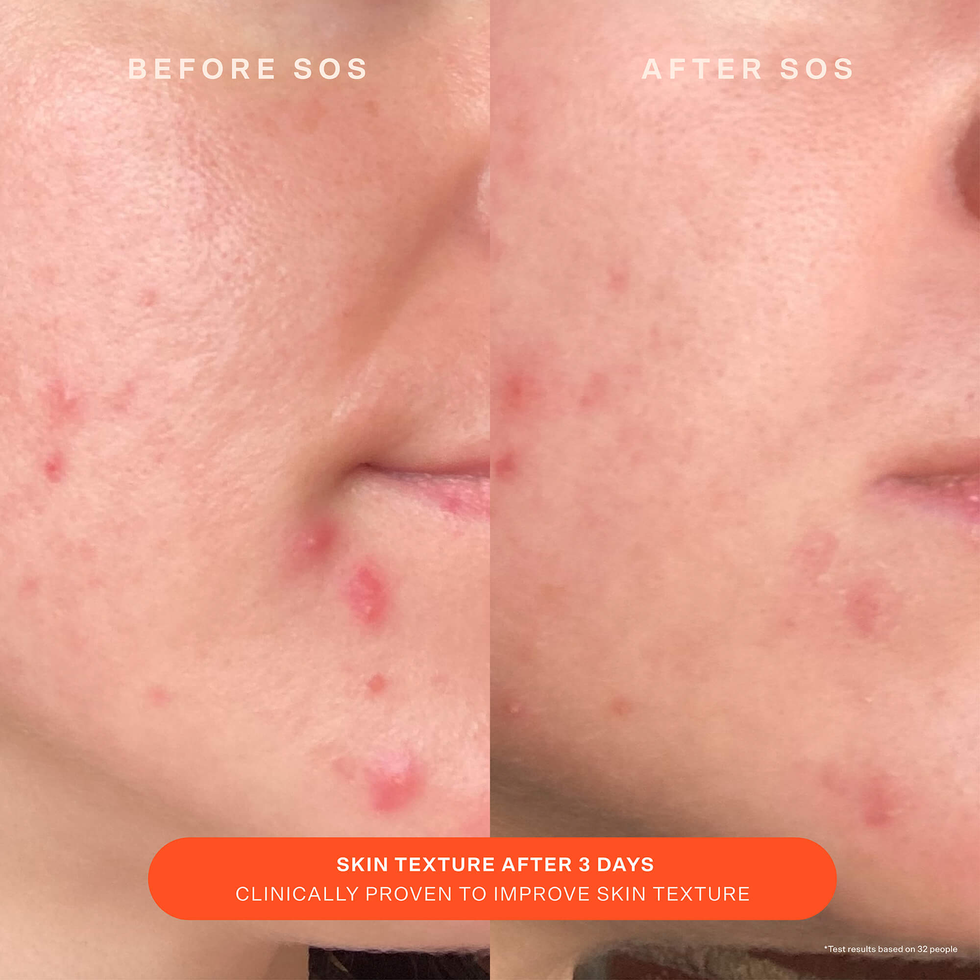 SOS Recovery Cream, image 8 of 11