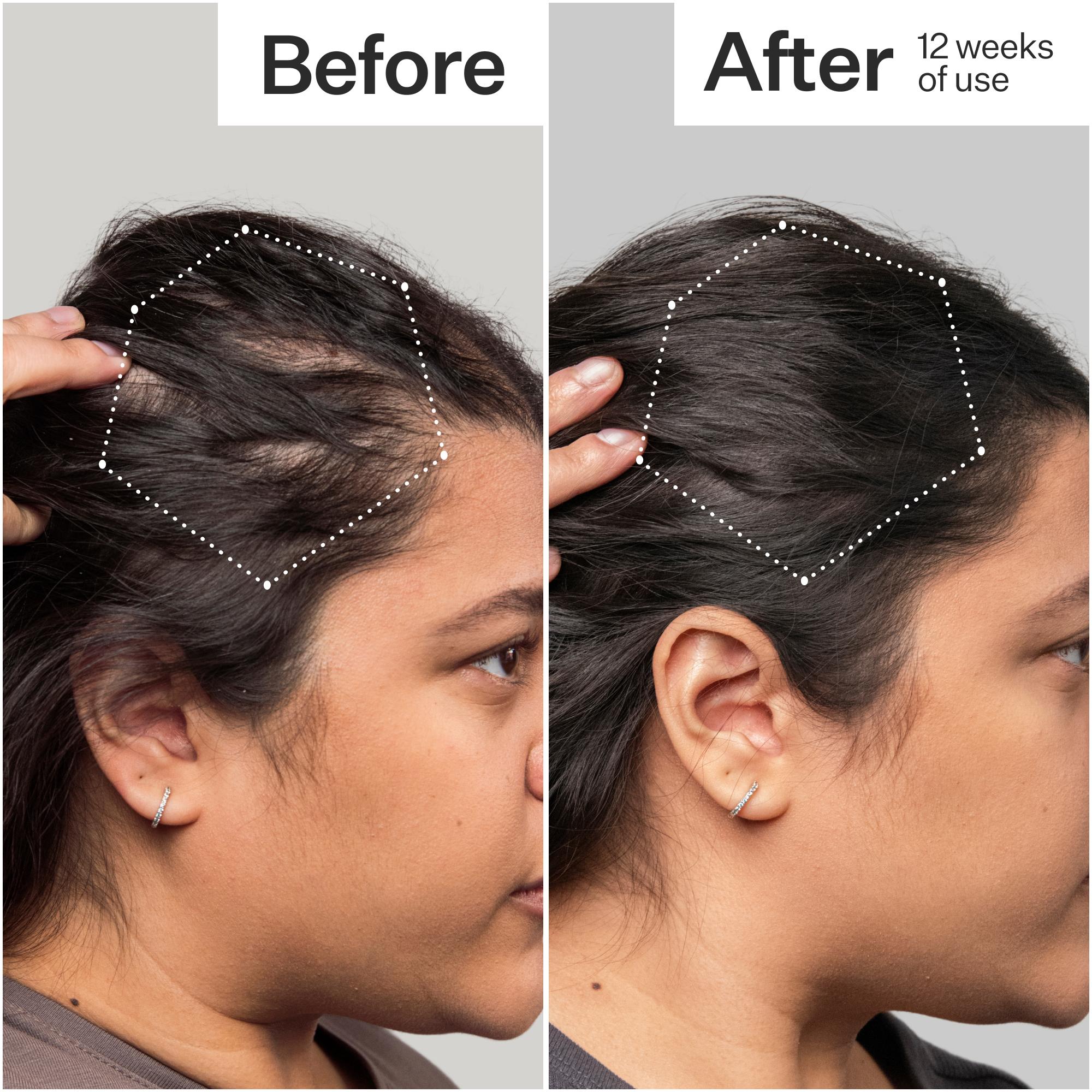 3% Stem Cell Peptide Treatment, image 3 of 12