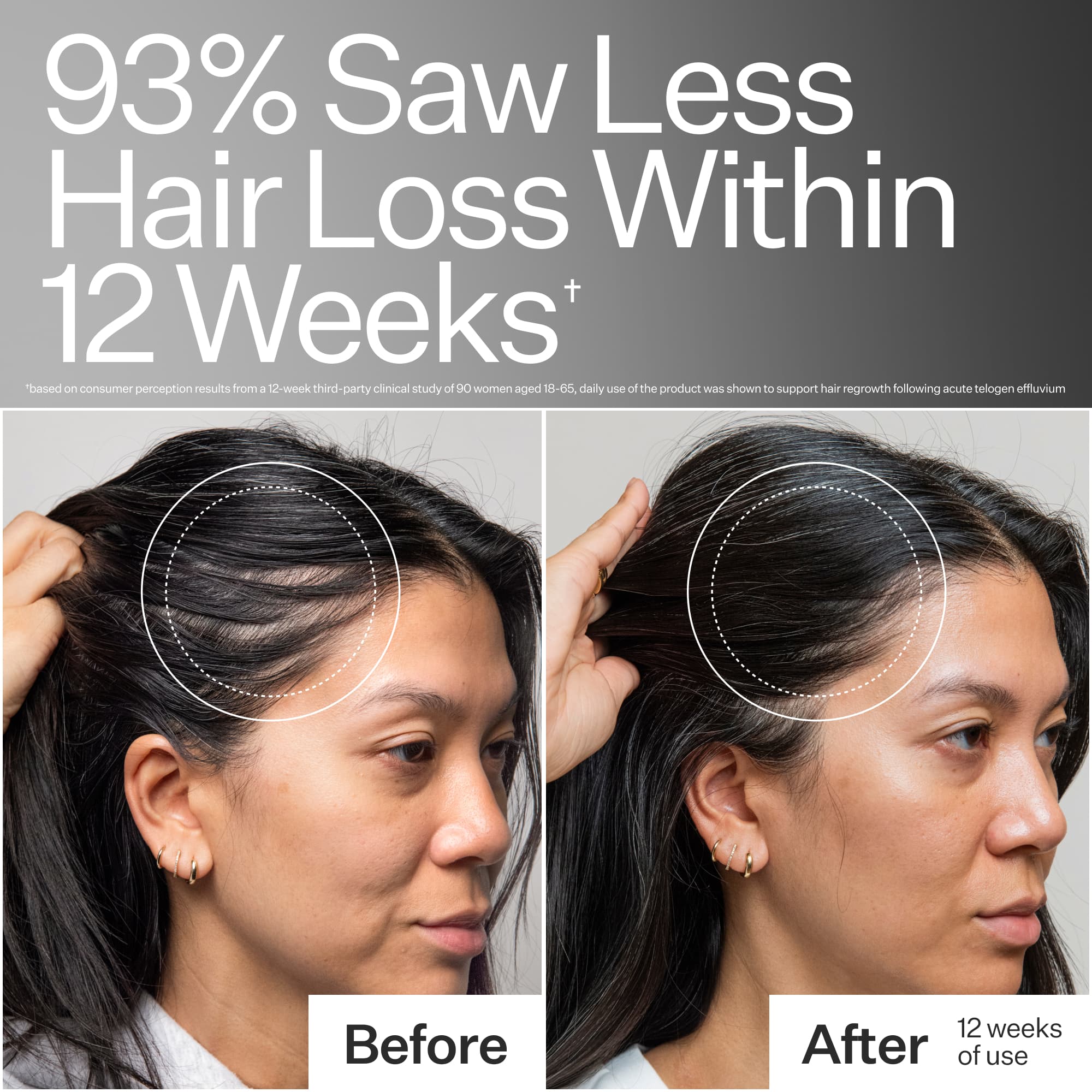 3% Stem Cell Peptide Treatment, image 4 of 12