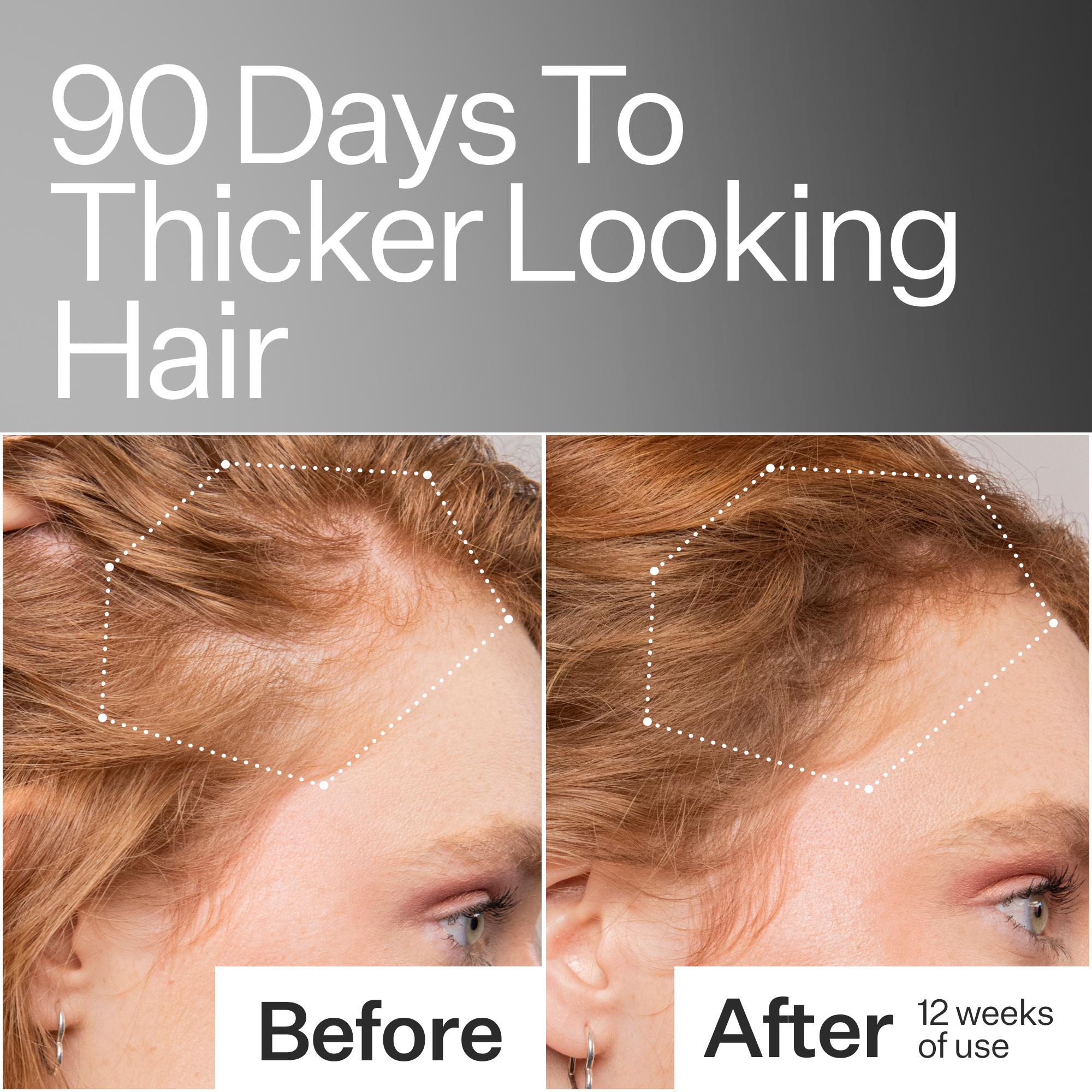 Stem Cell Scalp Serum™, image 4 of 14
